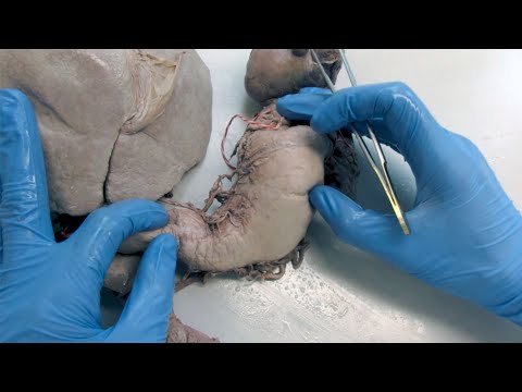 2 questions 1 organ - stomach