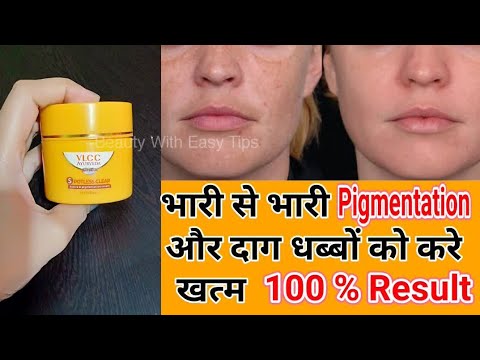 Ayurveda Spotless Clear D Pigmentation Cream Review