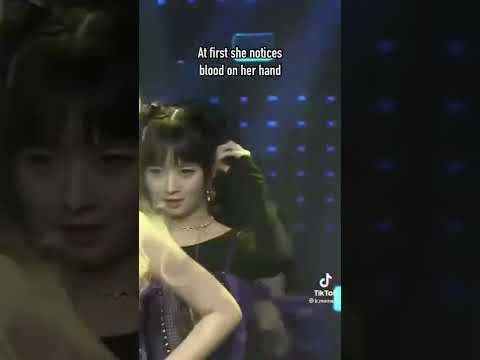 Wonyoungs knee bleed during “that’s my girl”