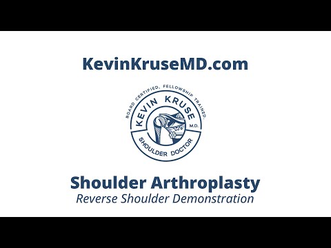Reverse Shoulder Arthroplasty Demonstration - Dr Kevin Kruse MD