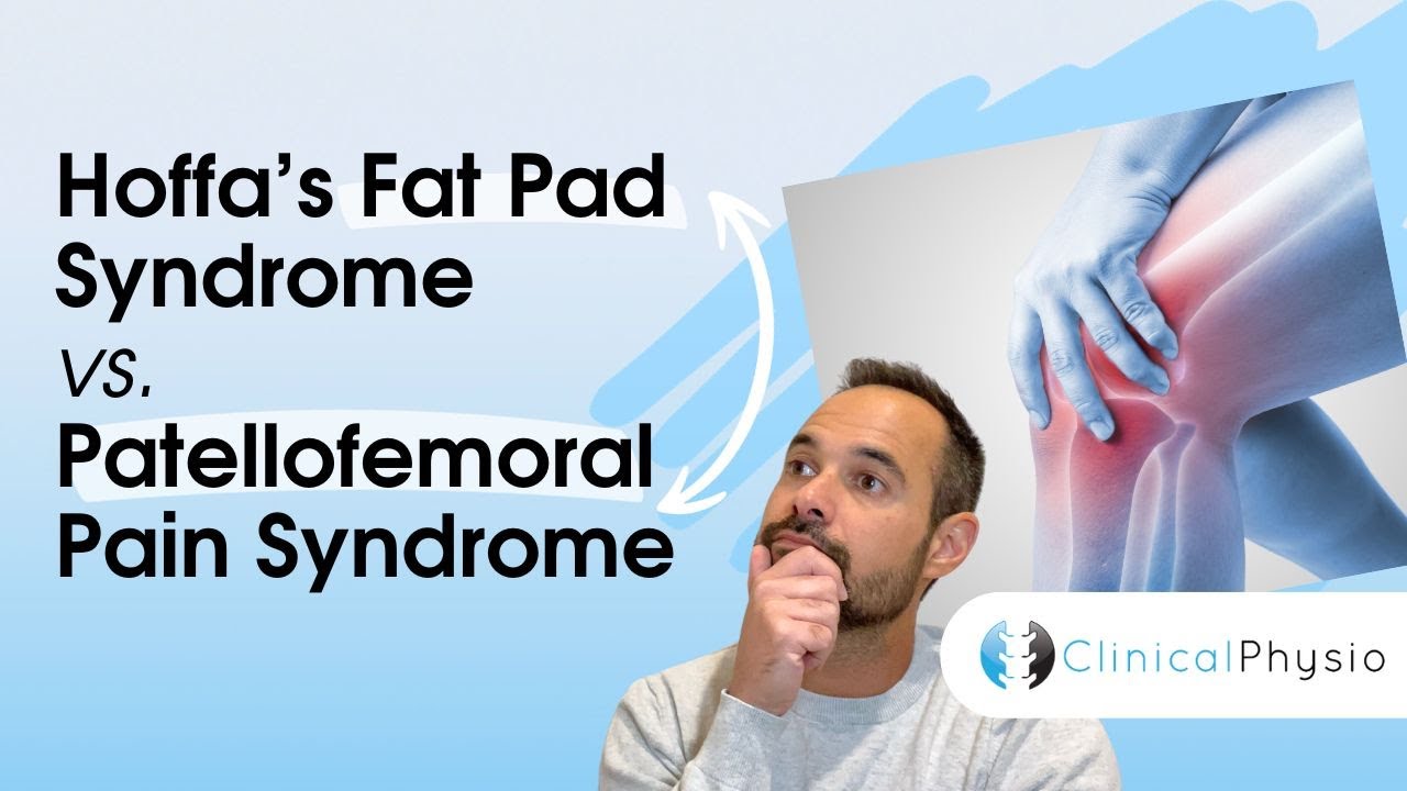 Hoffa’s Fat Pad Syndrome vs. Patellofemoral Pain | Expert Physio Guide
