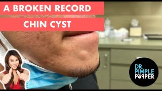 A Broken Record Cyst