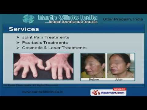 download lagu mp3 mp4 Earth Clinic Blackheads, download lagu Earth Clinic Blackheads gratis, unduh video klip Earth Clinic Blackheads