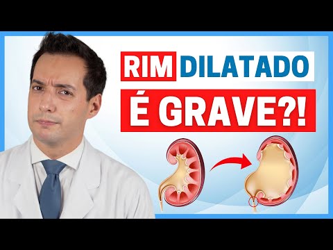 RIM DILATADO É GRAVE? CONHEÇA AS CINCO PRINCIPAIS CAUSAS E COMO TRATAR!