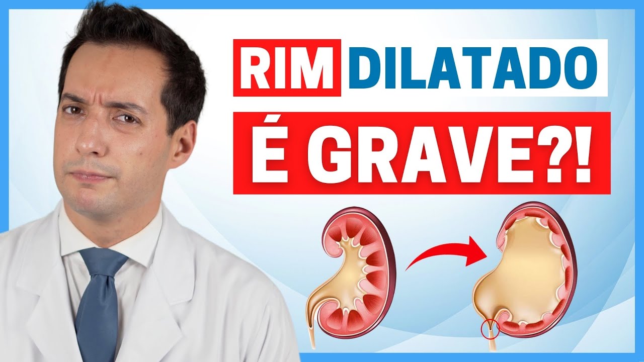 RIM DILATADO É GRAVE? CONHEÇA AS CINCO PRINCIPAIS CAUSAS E COMO TRATAR!