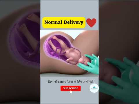 NORMAL CHILD DELIVERY | BABY BIRTH #shorts #youtubeshorts #viral