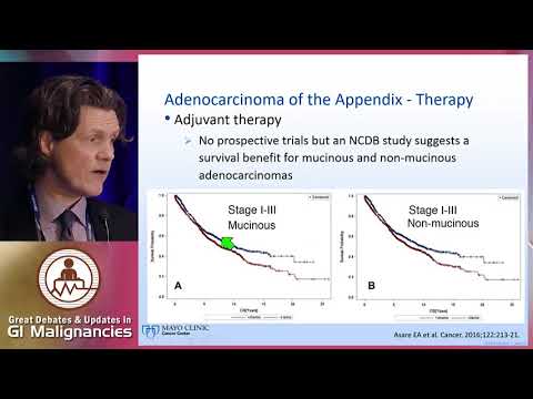 Management of appendiceal cancers: From pathology to treatment