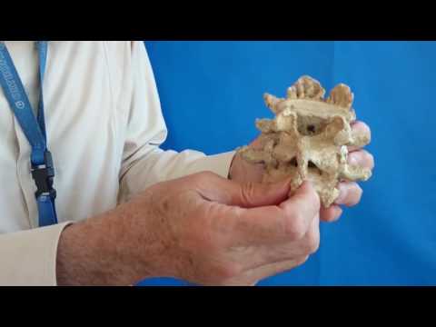 Polso brace piede Terapie tradizionali giri