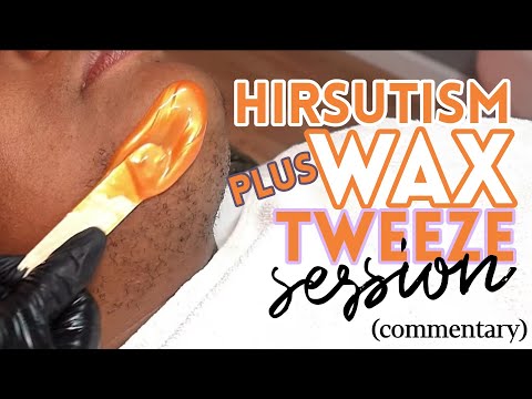 Hirsutism Facial Wax + Tweezing Session (COMMENTARY)