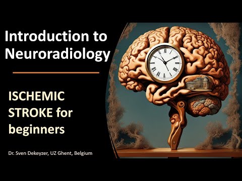 Imaging of Acute Ischemic Stroke: the basics!