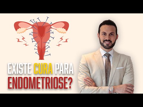 Is Endometriosis Curable? [Treatment for Endometriosis] | Dr. André Vinícius