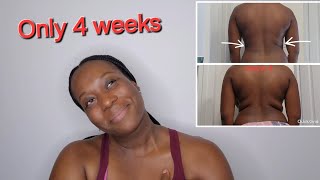I Got Rid Of of My Backfat/Rolls in 4 Weeks| No Diet | Simple Exercise