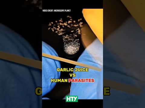 Garlic Juice vs. Parasitic Worms – You Won’t Believe This! 🍍🧬