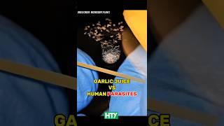 Garlic Juice vs. Parasitic Worms – You Won’t Believe This! 🍍🧬