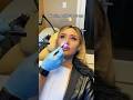 Getting My Nose Job Splints Out Gross But Funny Throwback Cosmetic Nose Crazy