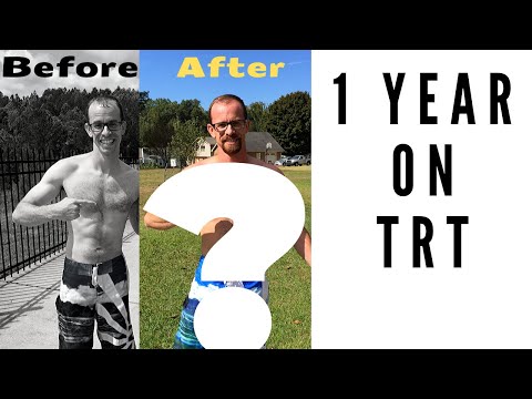 One Year On TRT (Testosterone Replacement Therapy)