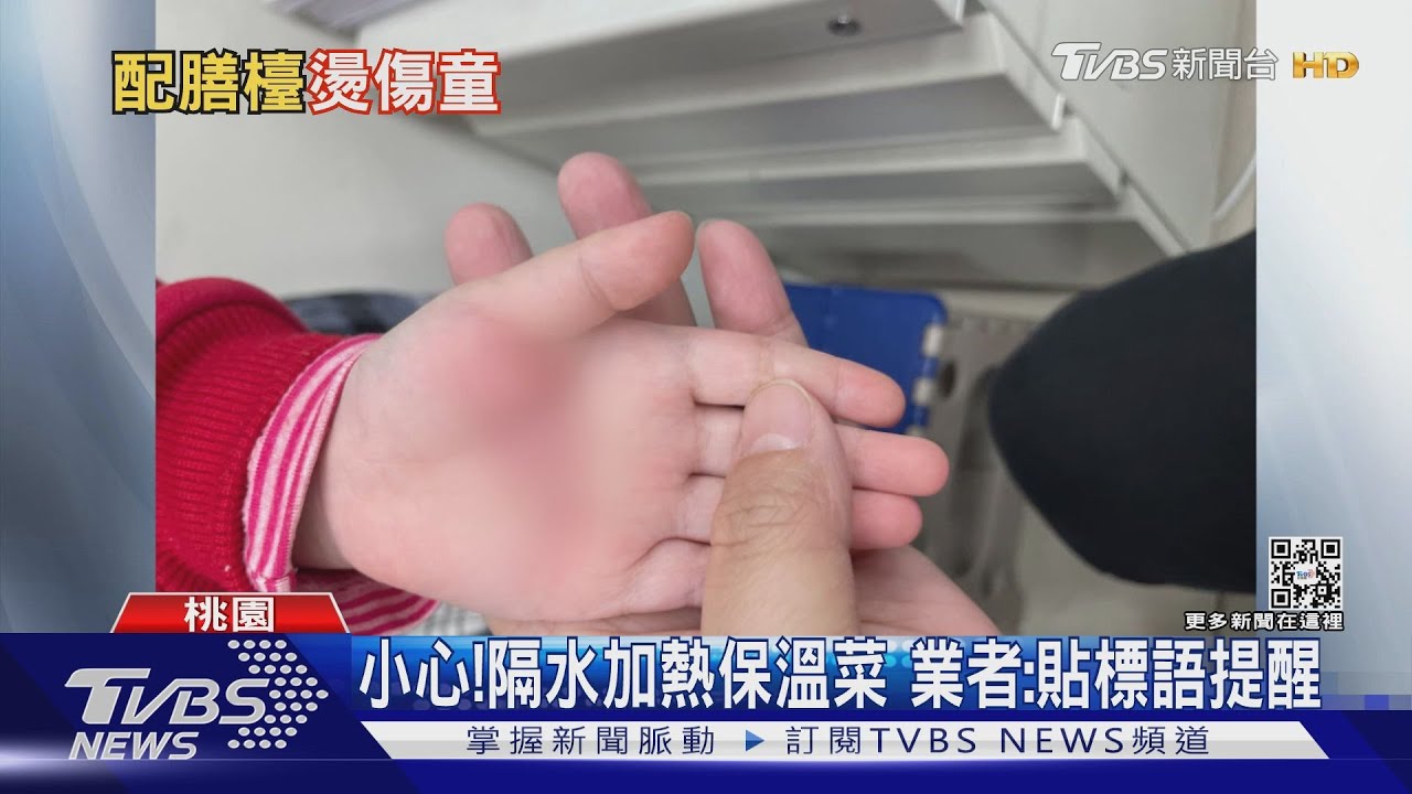 好燙!女童想看菜斯色 手誤觸配膳檯燙傷