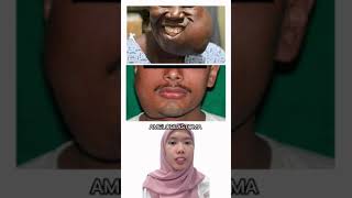 Download lagu Belajar bareng Mindy topik Ameloblastoma mp3 Download lagu Belajar bareng Mindy topik Ameloblastoma mp3