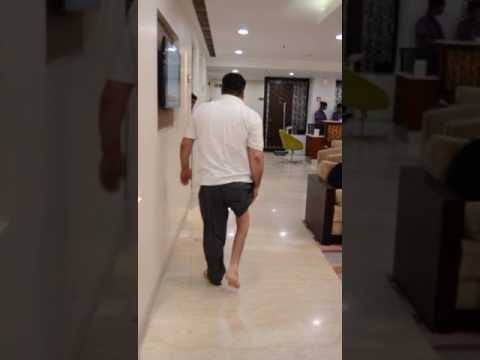 Post Polio Deformity — Patient Video