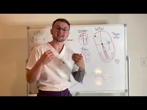 EKG Series: Wolff-Parkinson-White Syndrome Made Simple