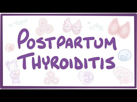 Postpartum thyroiditis - causes, symptoms, diagnosis, treatment, pathology