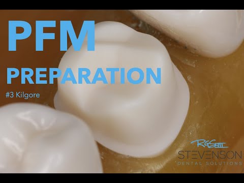 PFM Preparation #3 