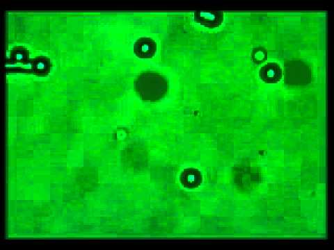 Optical trapping of a particle