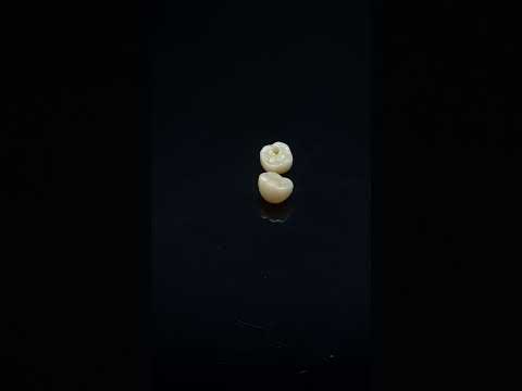YouTube 썸네일
