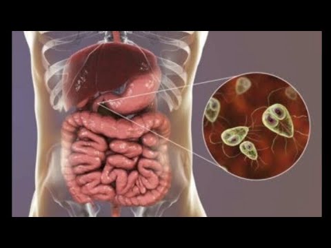 Giardiose flagellés intestinaux 3eme année médecine/révision résidanat résumé l'essentiel du cours