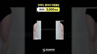 이 정도면 매끈매끈하다~ 허벅지 전·후 정리