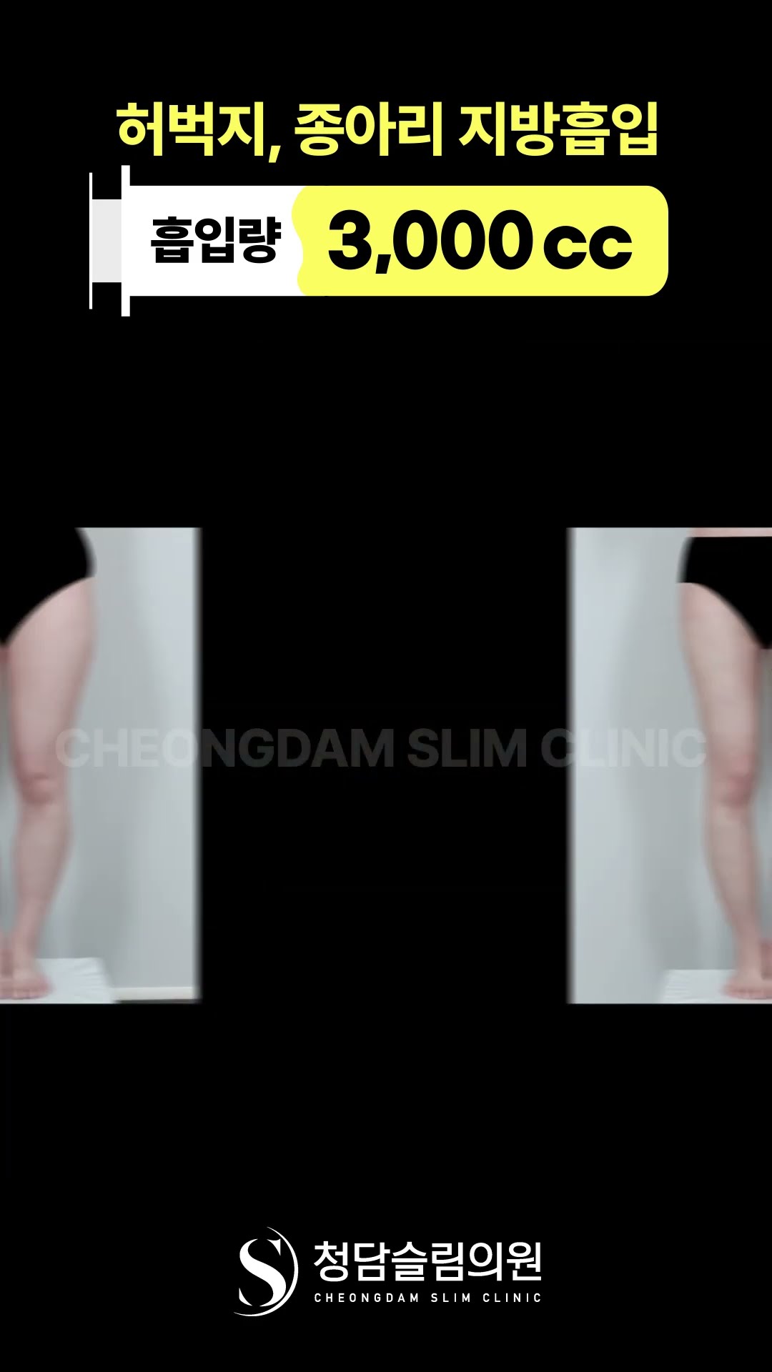 이 정도면 매끈매끈하다~ 허벅지 전·후 정리