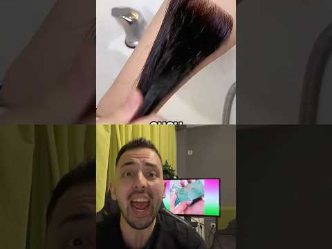 Φύτρωσαν τρίχες στο χέρι!🤚 #shorts