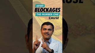Download lagu The #1 Cause of Blocked Arteries in 2025 You Need to Know mp3