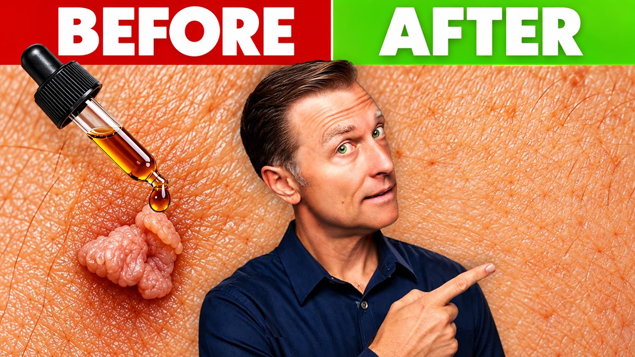 How to Get Rid of Skin Tags (& Stop Them For Good)