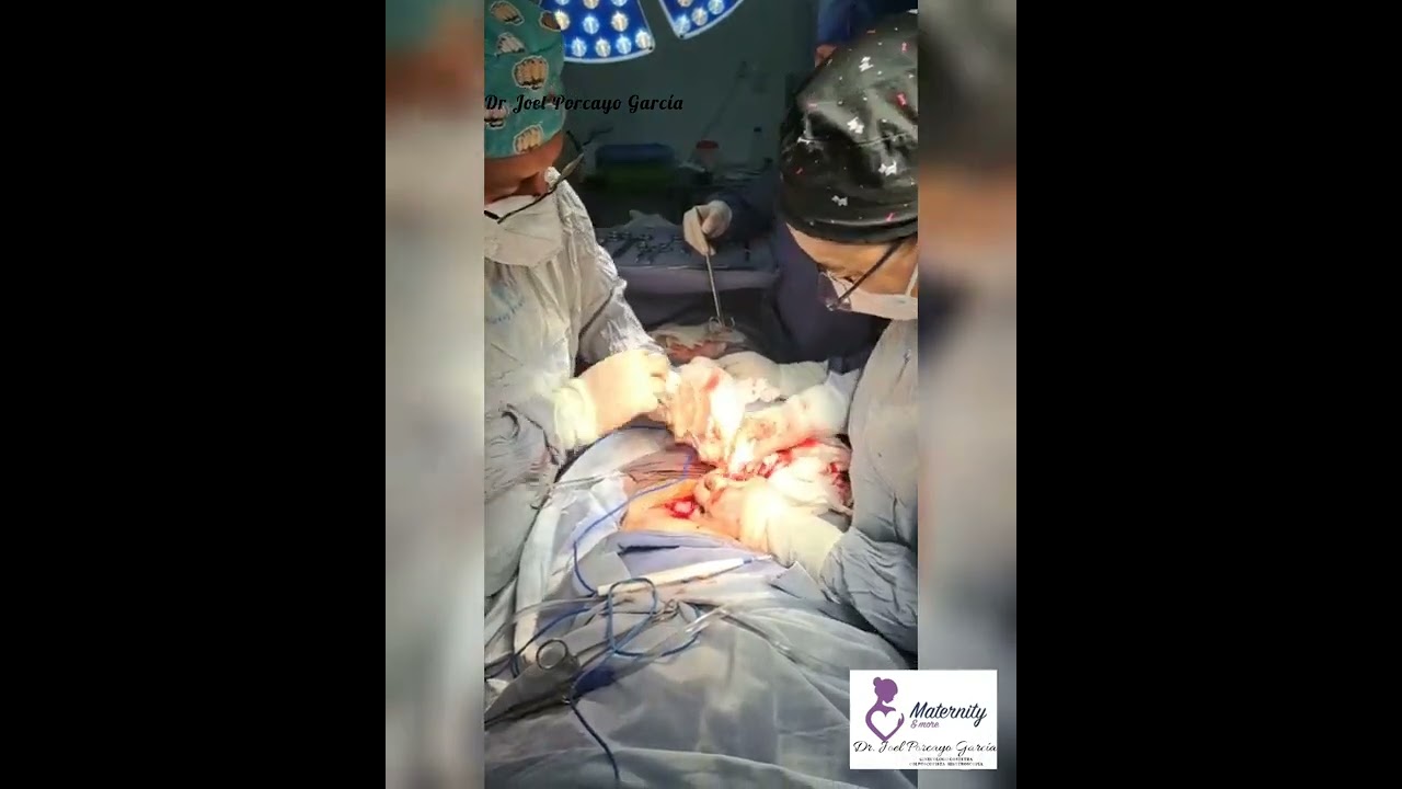 Joel Porcayo Garcia-27