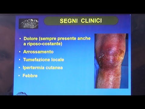Esercizi di fisioterapia per il ginocchio Articolazioni del gomito
