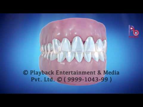 download lagu mp3 mp4 Khosla Dental Clinic Safdarjung, download lagu Khosla Dental Clinic Safdarjung gratis, unduh video klip Download Khosla Dental Clinic Safdarjung Mp3 dan Mp4 Full Gratis