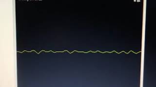 J Alvarez Necesitas De Mi ( Obligao Un Klasico) Preview 2018