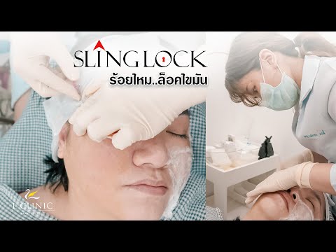 ร้อยไหม หน้าเรียว