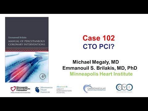 Case 102: PCI Manual - CTO PCI?