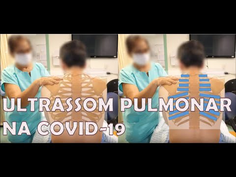 US pulmonar na COVID19 - Discussão de caso