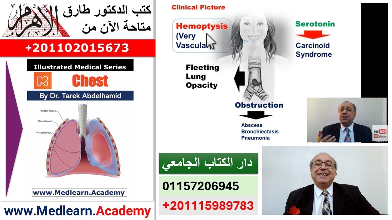 Bronchial Adenoma    #cme #internal_medicine #medical #usmle #محاضرات_باطنة