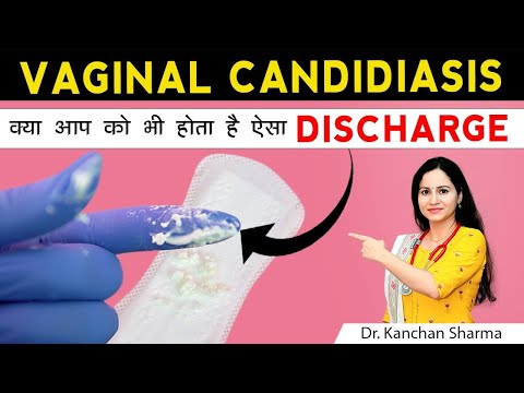 Vaginal Candidiasis | Vaginal Itching | योनि में जलन खुजली और इंफेक्शन के कारण और इसके घरेलू उपाय