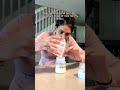 GERD vs spit up