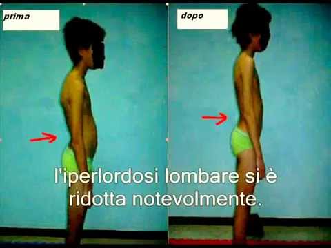 Colonna vertebrale dolorante e tutte le articolazioni che Capsule di nome osteocondrosi