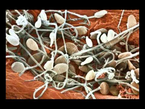 Helminths e nausea Quando i vermi dopo un nemozol cominciano a partire