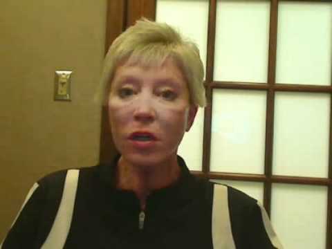Patient Testimonial for Facelift