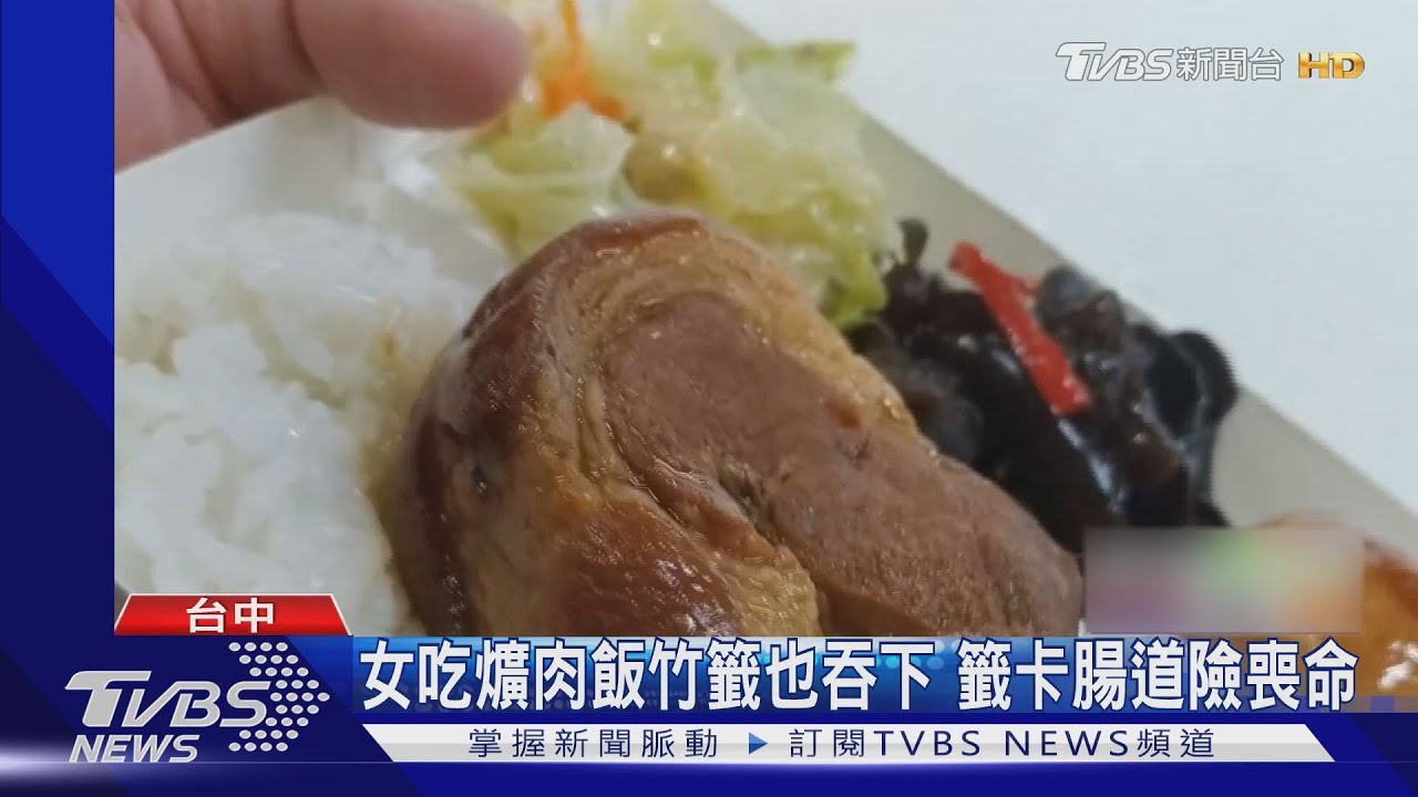 女吃爌肉飯竹籤也吞下 籤卡腸道險喪命