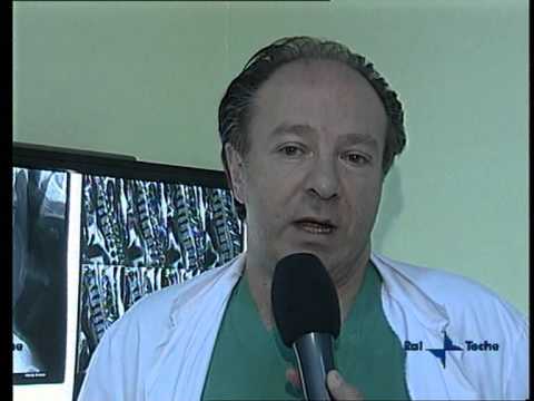 Compresse artro per istruzione congiunta Punto girudoterapii quando la colonna vertebrale cervicale