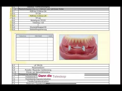 Coverdenture-Prothesen oder Deckprothesen - HKP abrechnen 3/4